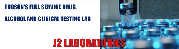Tucson’s Full Service Drug, Alcohol And Clinical Testing Lab, J2 Laboratories, Drug and Alcohol Testing, Clinical and Oral Fluid Testing