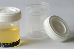 Employee drug testing - specimen collections